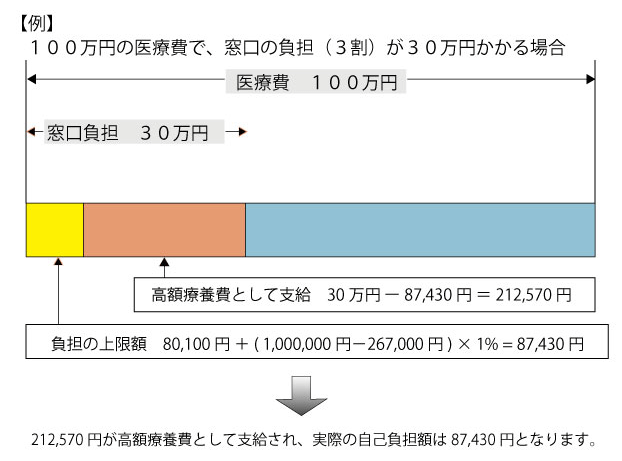 100万円の医療費で窓口の負担が30万円かかる場合212,570円が高額医療費として支給され、自己負担額は87,430円となります。