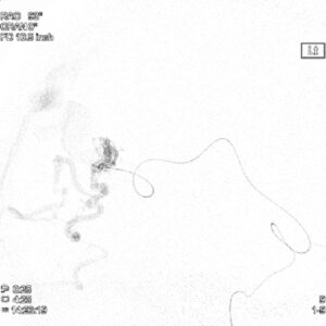 治療方法