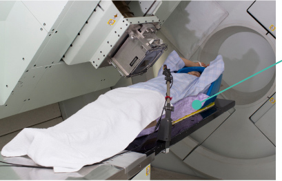 The patient lies in an immobilization device which has been custom-made to the shape of the patient’s body to help him/her keep still while receiving proton therapy. (The patient may also have to wear an immobilization device for his or her head).