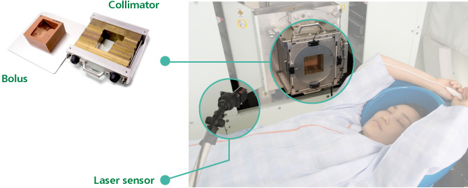 A bolus (left) and a collimator (right) are custom-made for each patient so as to fit the size and depth of his or her tumor. If a proton beam is administered from different angles, a bolus and a collimator are made to fit each angle.