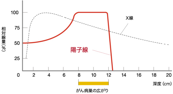 02 陽子線治療は病巣のみにピンポイントで放射線を照射します。