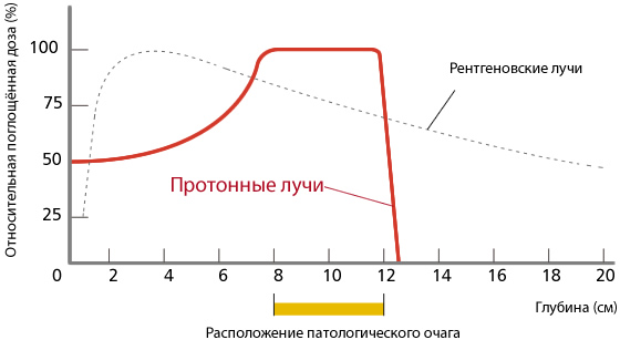 02 Протонная терапия прицельно воздействует 
на патологический очаг.